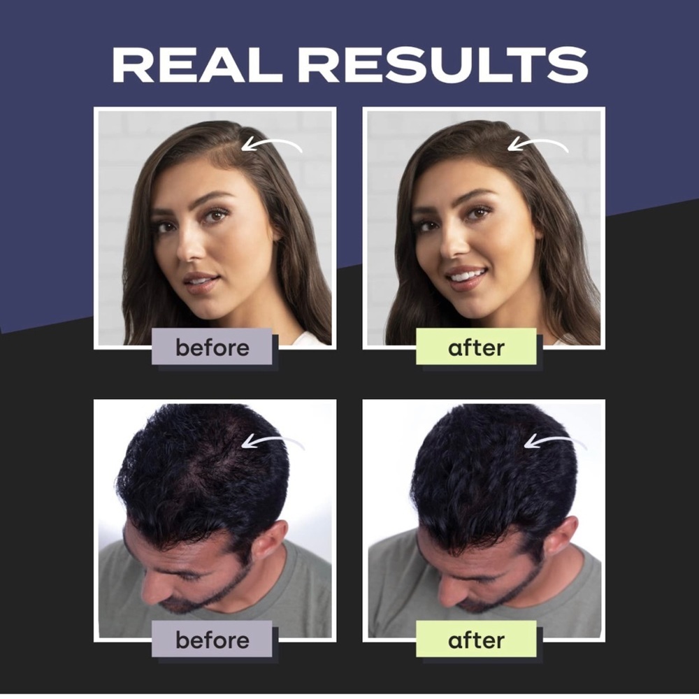 Toppik keratin hair fibers 27.5g available in all colors price drop - Picture 6 of 15